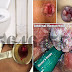 Ambeclear Obat Wasir di Apotik Umum Apa Ada thumbnail