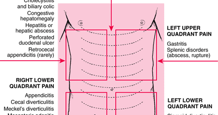 Abdominal Quadrant Chart