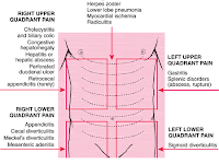 Stomach Pain Diagram Stomach Pain Diagram