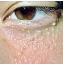 I mezzi schiarenti per pelle di faccia da Avon
