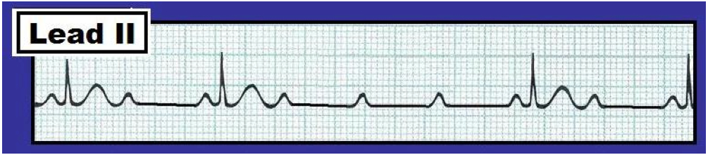 hyperengine av review hyperengine av review