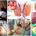 Mengobati Wasir dengan Propolis dan Ambeclear thumbnail
