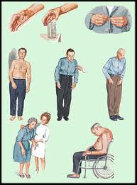 Obat parkinson Obat parkinson