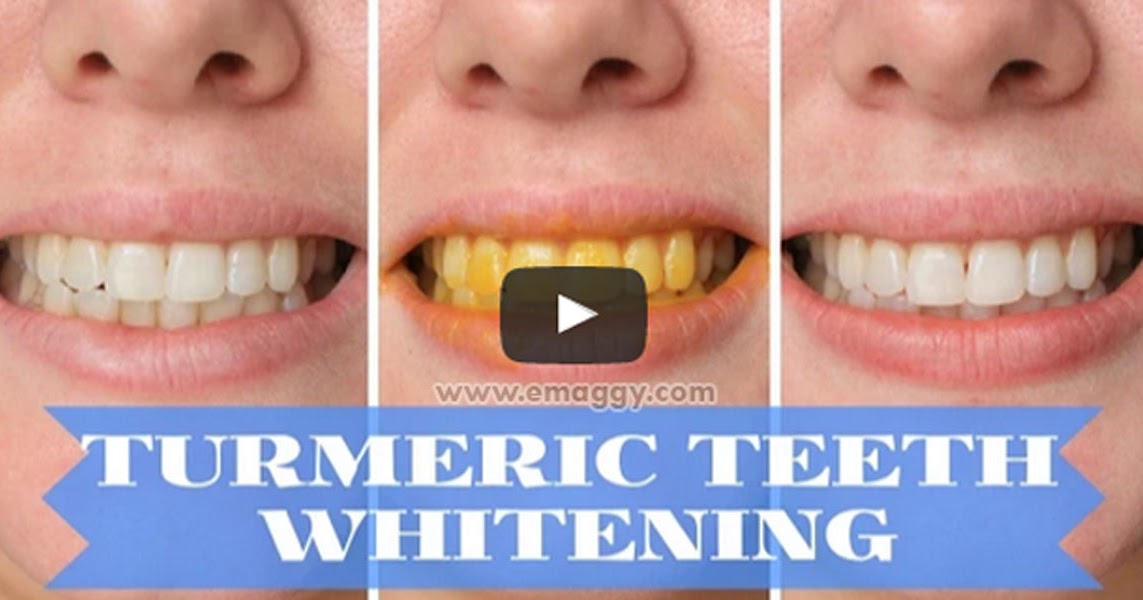 Learn Easy Tricks How To Whiten Your Teeth Instantly Using Turmeric