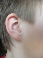 DDS - A dor de ouvido e o protetor auricular