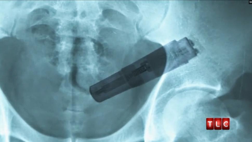 Толстая Жопа Вибратор