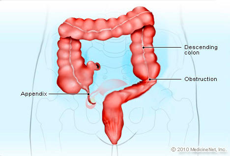 vermiform appendic Everything about important question and answer on location/position of appendix, referredpain in appendicitis, blood and nerve supply of vermiform appendix. vermiform appendic Everything about important question and answer on location/position of appendix, referredpain in appendicitis, blood and nerve supply of vermiform appendix.