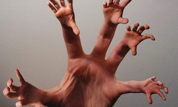 синдром ванземаљске руке