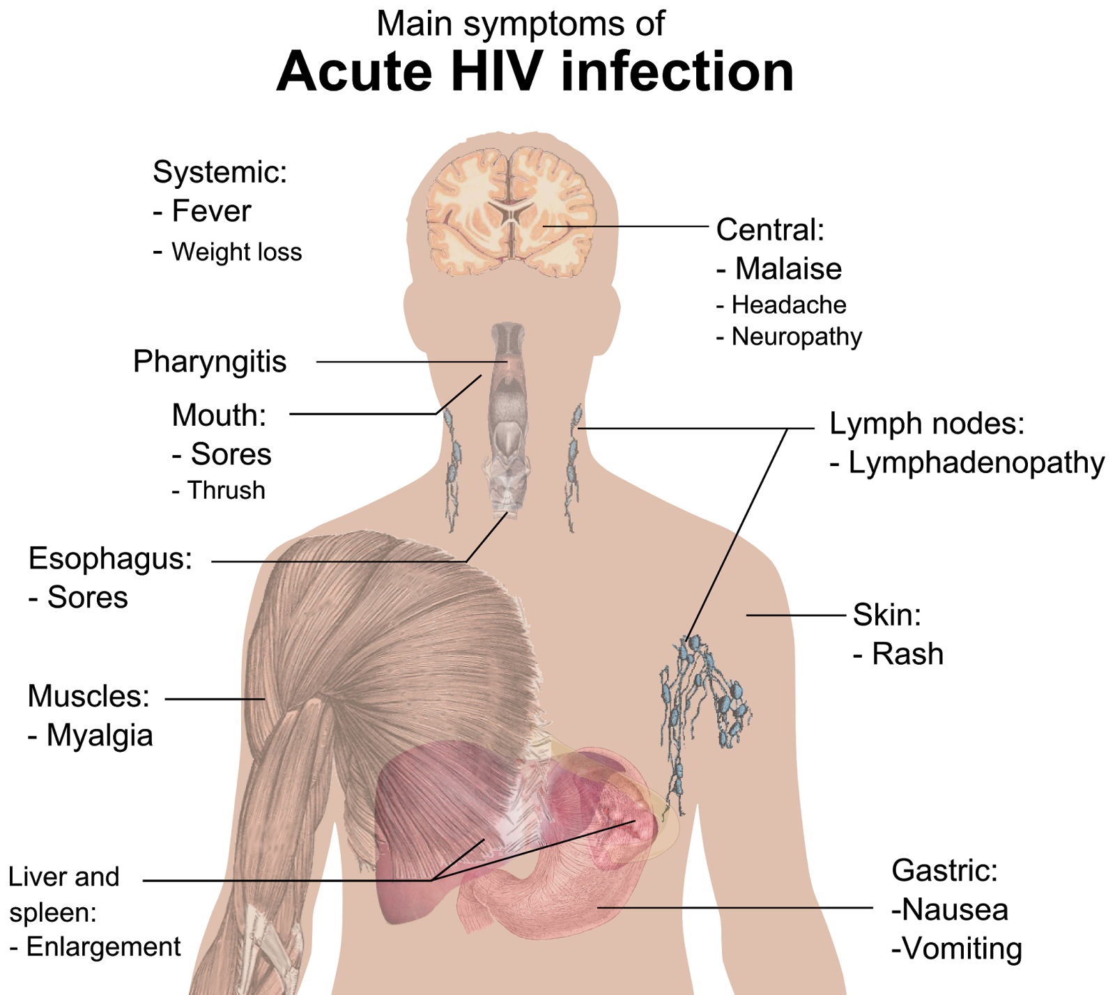 Symptoms of AIDS: how to identify the disease Symptoms of AIDS: how to identify the disease