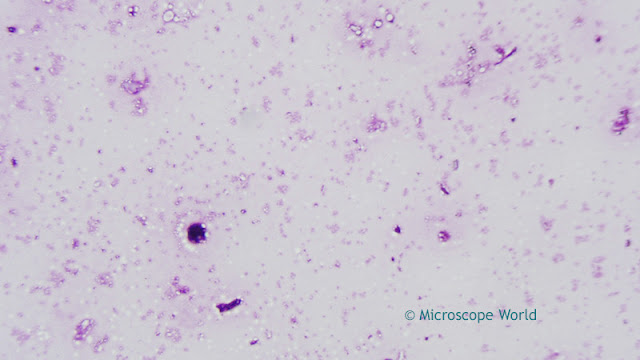 Microscope image of Dog Whooping Cough at 400x.