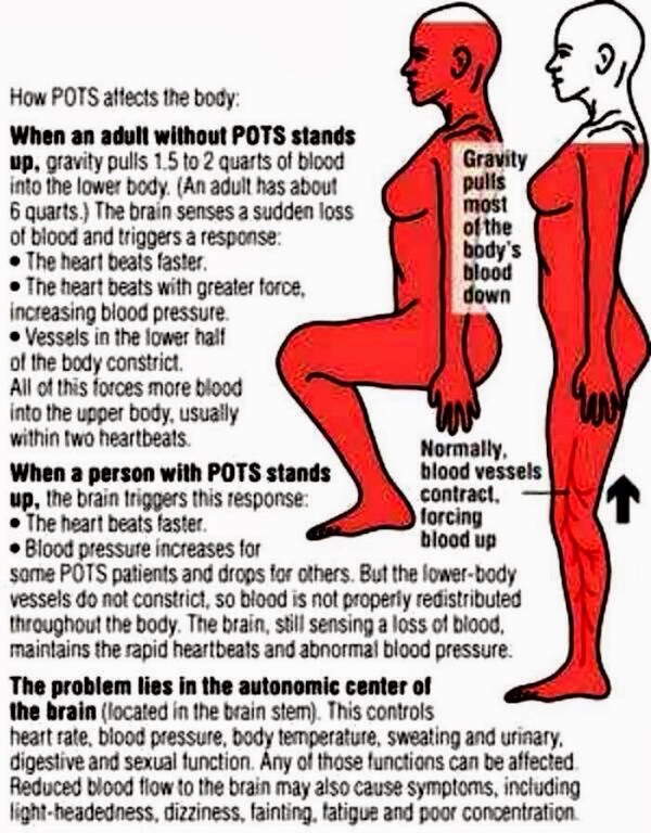 dysautonomia pots