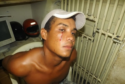 Jovem mostra o ferimento provocado pelo facão