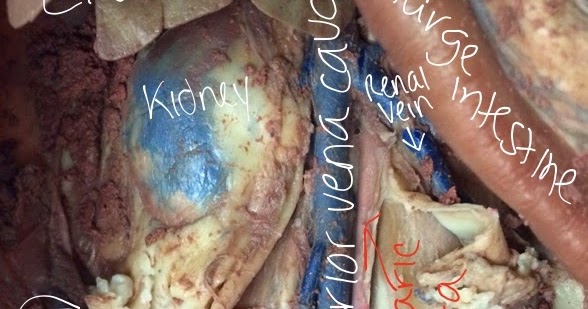 Semara's Mystifying Anatomy: The Veins and Arteries Below the Diaphragm