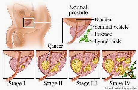Masturbation and prostate The amateur cracksman