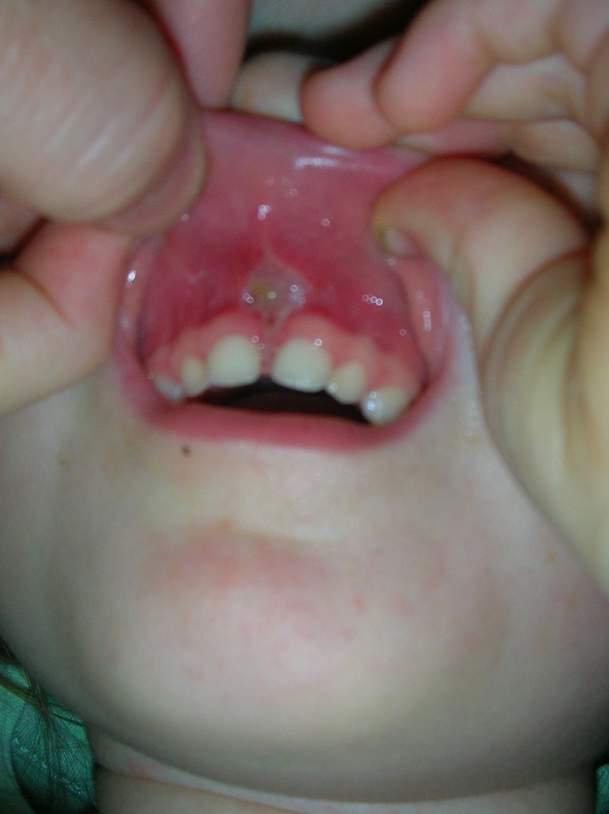 Father Healer An Advocates Tale It Took All of TWO Minutes!