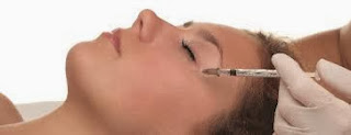 Hyaluronic Acid Injections