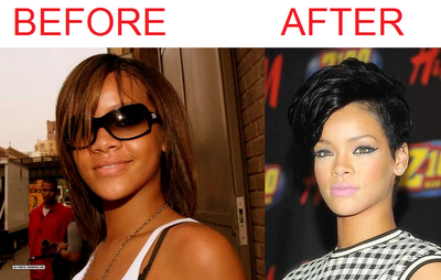 skin-bleaching-rihanna.png