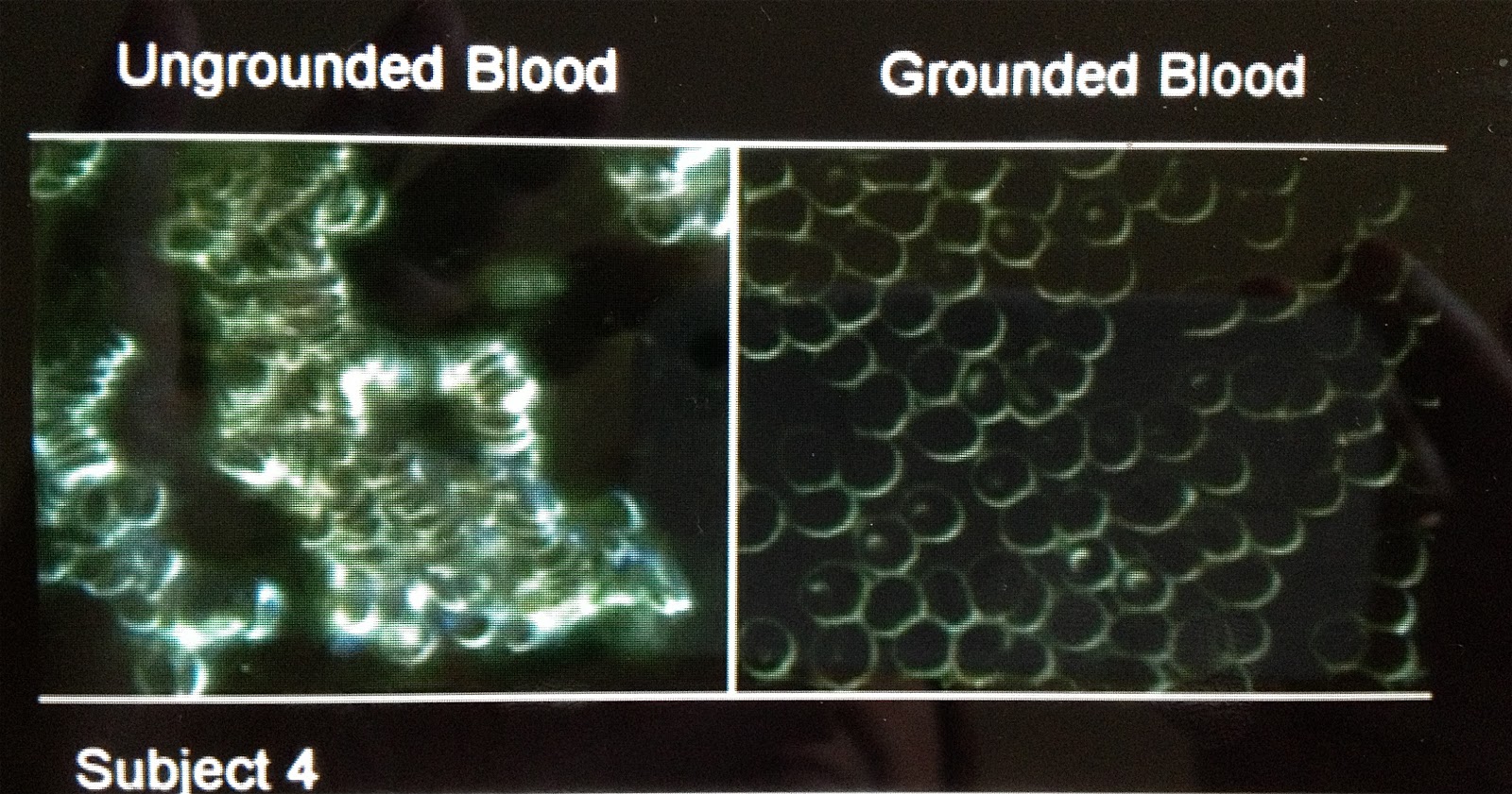 Grow Old Naturally Blood Thinning with Earthing