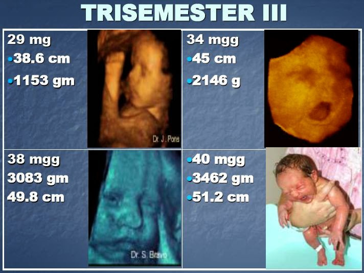 Massa perkembangan bayi dalam kandungan (pranatal)