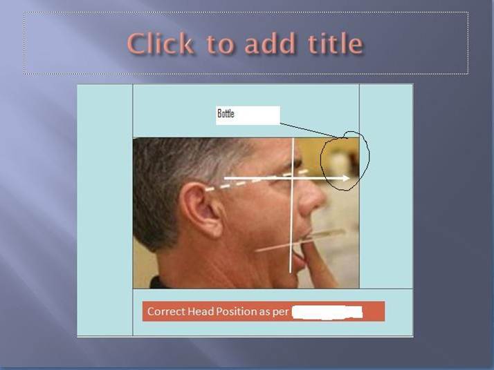 Occlusion Connections Blog What Angle is the Occlusal Plane Relative