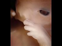 fetus at 10 weeks