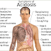 Renal Tubular Acidosis Disease