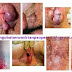 Obat Herbal Ambeclear Ampuh Mengobati Wasir Berdarah thumbnail
