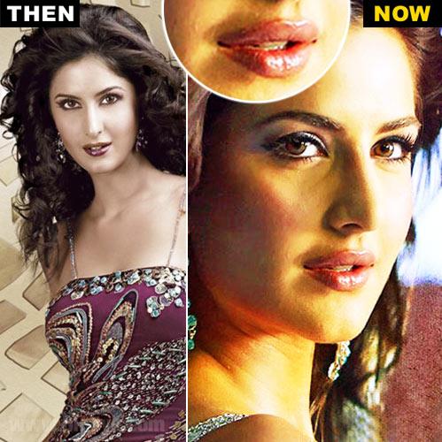 Chatter Busy: Katrina Kaif Plastic Surgery
