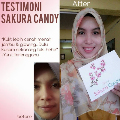 Sakura Candy - Mencerah dan Menjaga Dalaman Wanita 