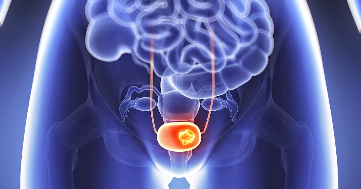¿Por qué ocurre el Prolapso de la pelvis?
