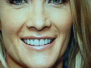 The Scat From Fox News Commentary On Fox News Anchors The