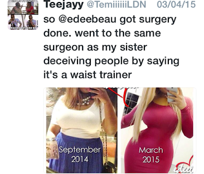 Busted! Lady who claims she got this tiny waist from wearing a waist trainer rather than surgery gets caught!
