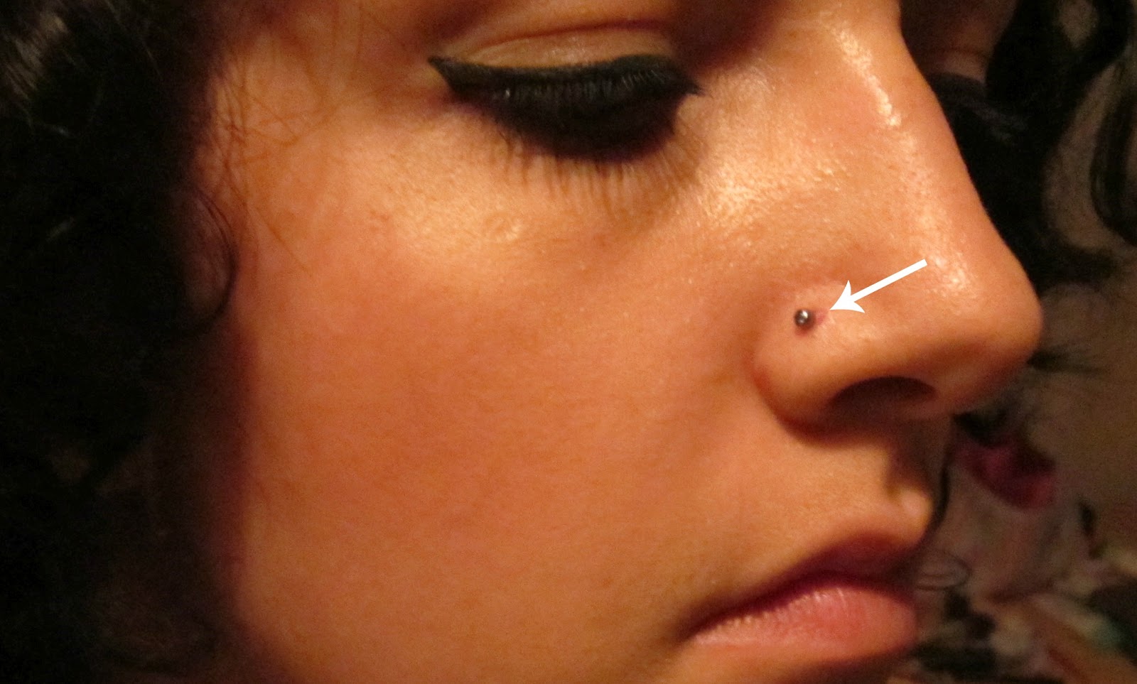 Why is there a bump next to my nose piercing?