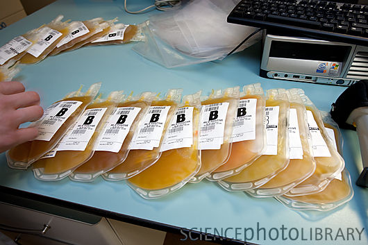Apheresis plavix