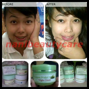 cream+walet+aloevera+testimonial.jpg