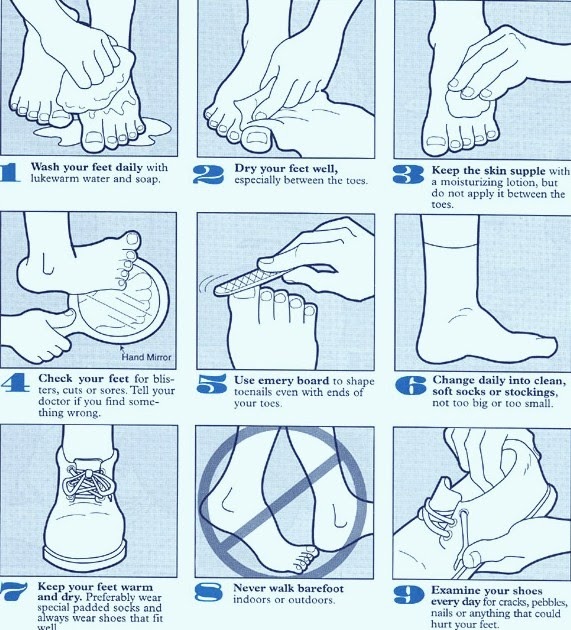 Keeping it Simple (KISBYTO) Diabetes Foot Care