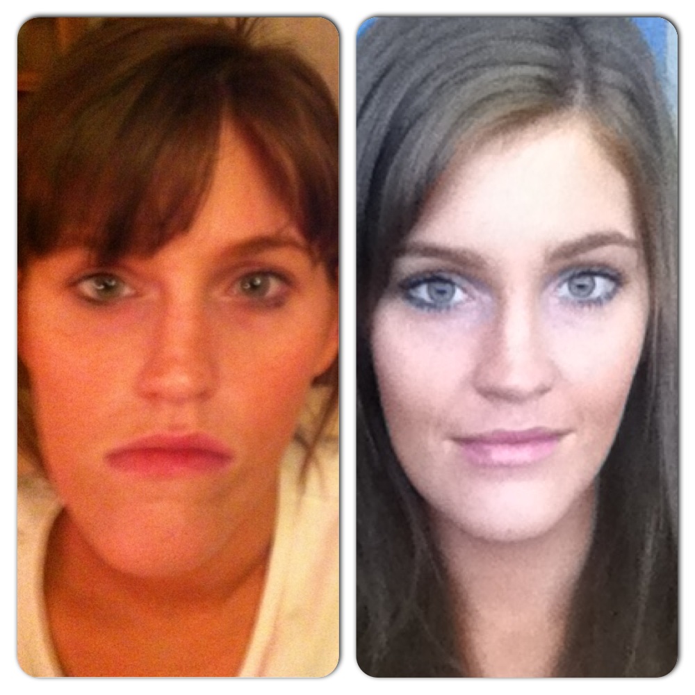 A Guide to Surviving Orthognathic Surgery FAQ Orthognathic Surgery