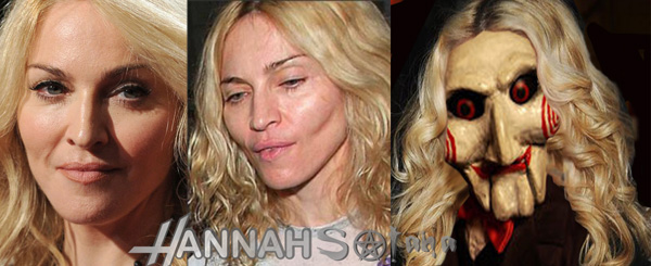 Image result for madonna plastic surgery pics