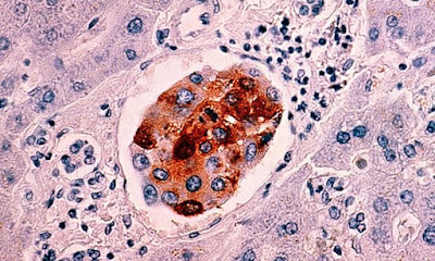 Thuốc Beta Glucan betaglucan