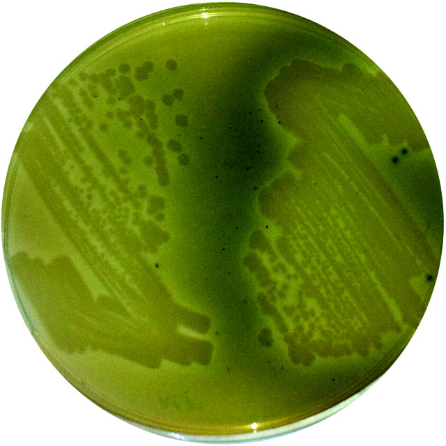 Gold Digging Bacteria could be useful metal recovery aid from waste