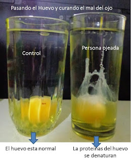 El precio endoscópico lifting las personas