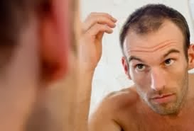 Bahaya Merokok Mengakibatkan Rambut Rontok Alias Botak Bahaya Merokok Mengakibatkan Rambut Rontok Alias Botak