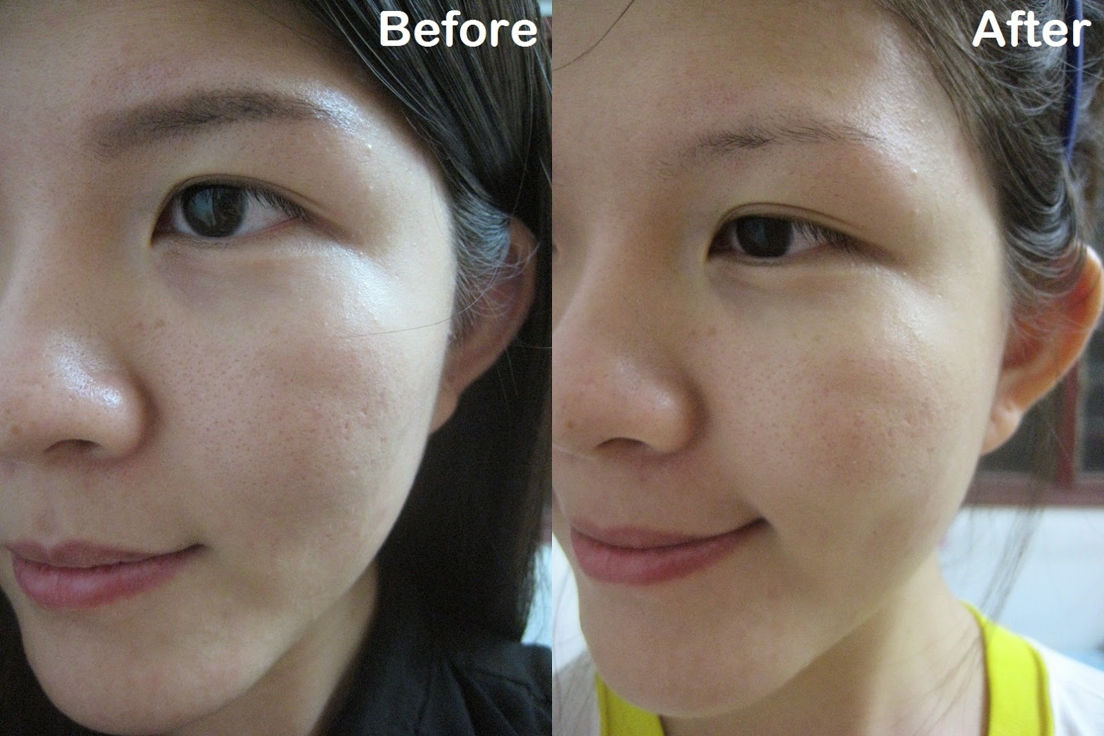 skin toner before and after