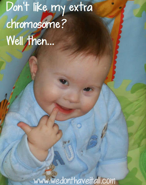 Down Syndrome Cuteness Down Syndrome Cuteness
