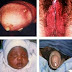Nama Obat Anti Gonore Sembuh Total thumbnail