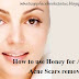 How to use Honey for Acne and Acne Scars removal