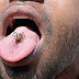 Indian Youth Addicted To Eat Insects