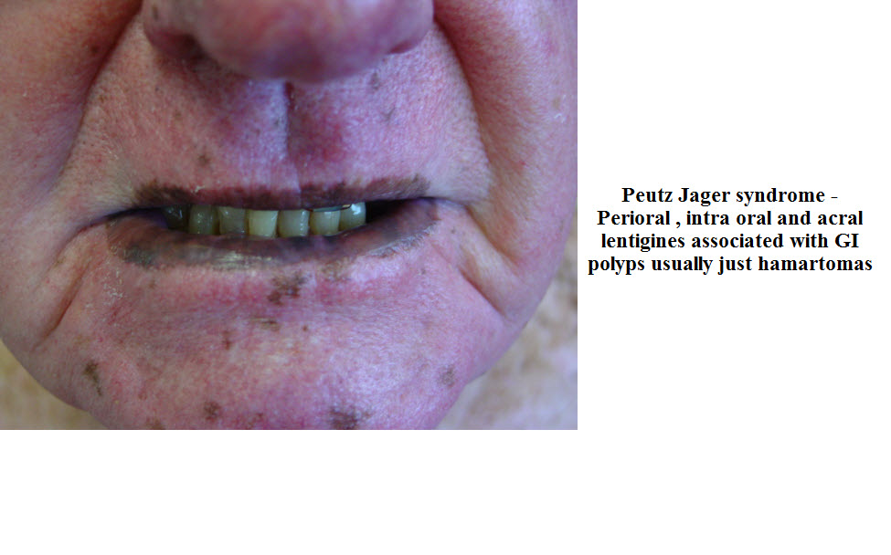 Dermatology For Dentists and Dental Students Oral Medicine for Dental