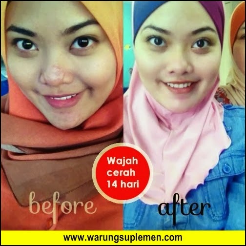 Bukti dan Testimoni Emilay whitening Bukti dan Testimoni Emilay whitening