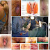 Penyebab Umun Wasir (Ambeien) Pada Wanita Hamil thumbnail